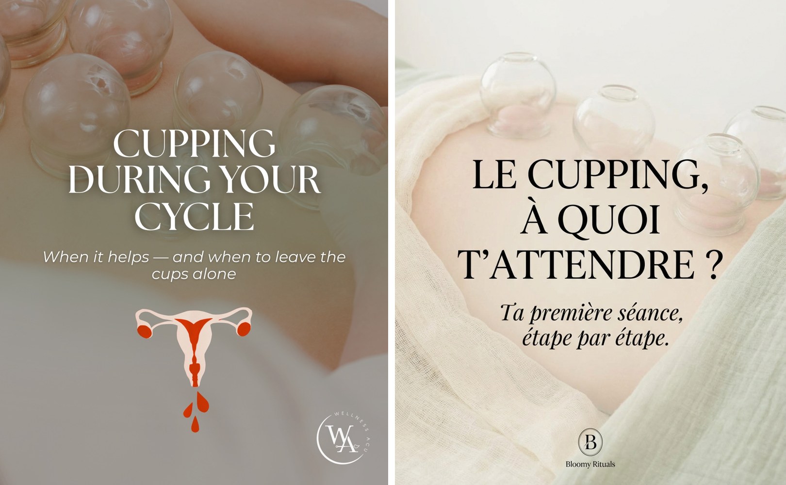 Post original admiré — le cupping, ta première séance