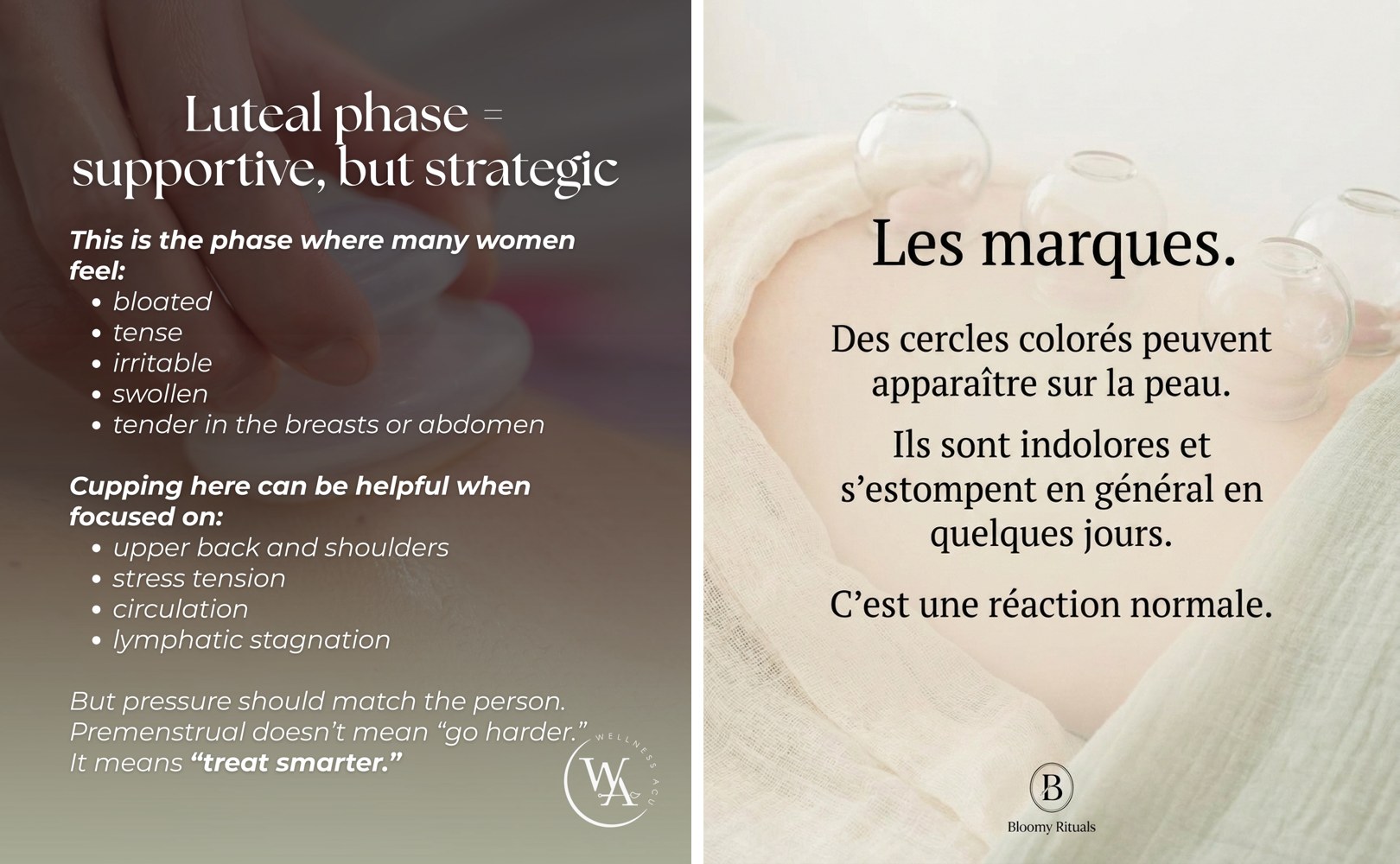 Slide 5 — le cupping, ta première séance