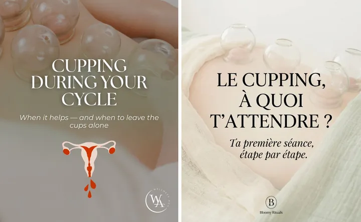 L'original admiré à gauche, sa reproduction à droite, sur le sujet « le cupping, ta première séance »